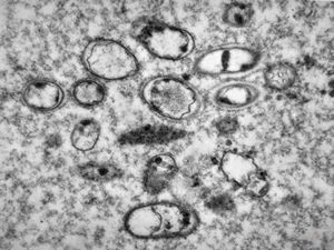 phagocytosed microbes phagocytosed microbes